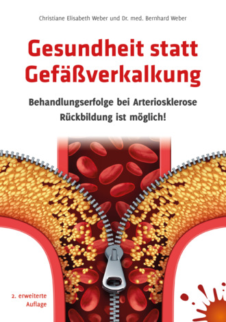 Dr. med. Bernhard Weber. Gesundheit statt Gef??verkalkung