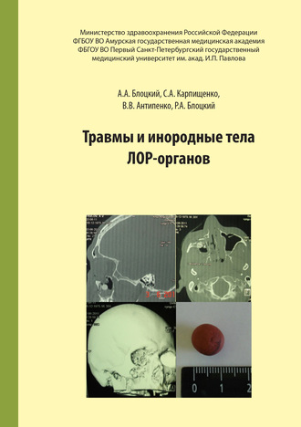 Обложка книги «Травмы и инородные тела лор-органов»