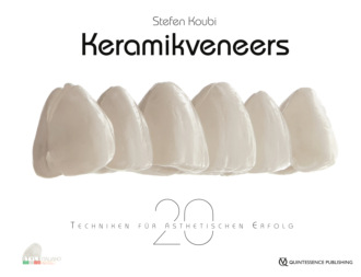 Stefen Koubi. Keramikveneers