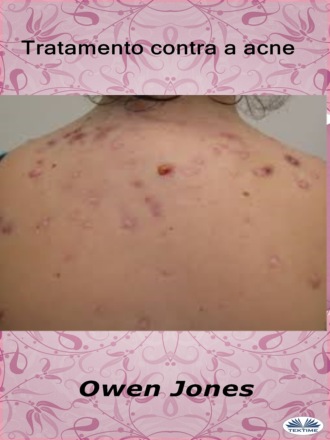 Обложка книги «Tratamento Contra A Acne»