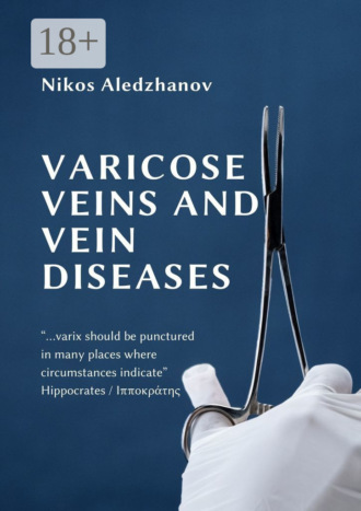 Обложка книги «VARICOSE VEINS AND VEIN DISEASES»