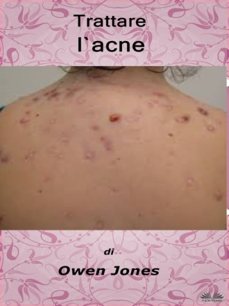 Обложка книги «Trattare L'Acne»