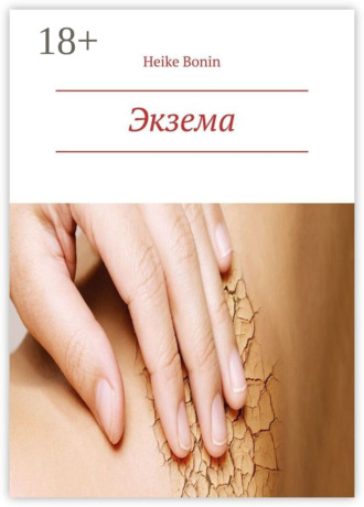 Обложка книги «Экзема»