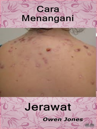 Обложка книги «Cara Menangani Jerawat»
