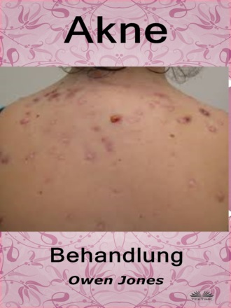 Обложка книги «Akne-Behandlung»