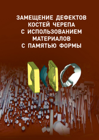 Обложка книги «Замещение дефектов костей черепа с использованием материалов с памятью формы»