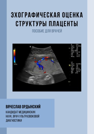 Обложка книги «Эхографическая оценка структуры плаценты»