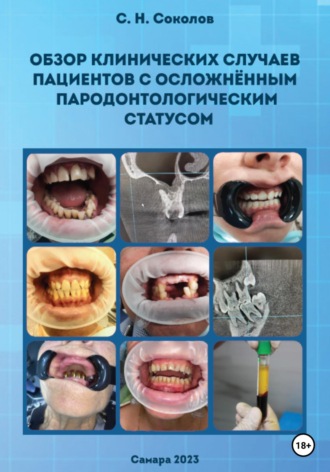 Обложка книги «Обзор клинических случаев пациентов с осложнённым пародонтологическим статусом»
