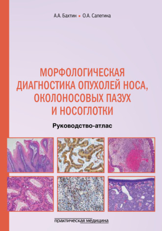 Обложка книги «Морфологическая диагностика опухолей носа, околоносовых пазух и носоглотки»