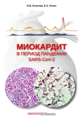 Обложка книги «Миокардит в период пандемии SARS-CoV-2»