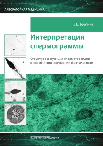 Обложка книги «Интерпретация спермограммы. Структура и функция сперматозоидов в норме и при нарушении фертильности»