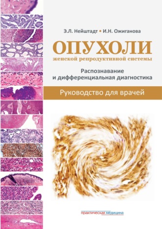 Обложка книги «Опухоли женской репродуктивной системы. Распознавание и дифференциальная диагностика. Руководство для врачей»