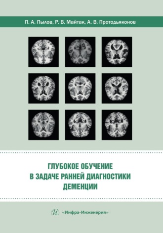 Обложка книги «Глубокое обучение в задаче ранней диагностики деменции»