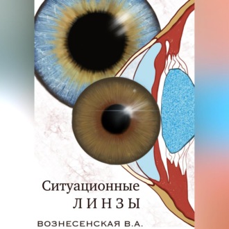 Обложка книги «Ситуационные линзы»