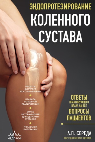 Обложка книги «Эндопротезирование коленного сустава. Ответы практикующего врача на все вопросы пациентов»