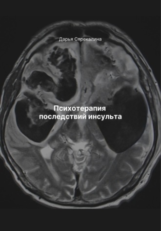 Обложка книги «Психотерапия последствий инсульта»