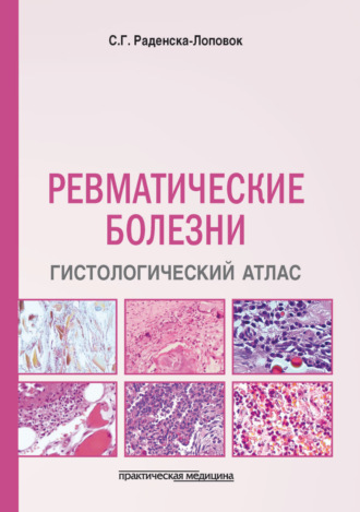 Обложка книги «Ревматические болезни. Гистологический атлас»