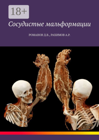 Дмитрий Романов. Сосудистые мальформации