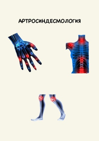 Обложка книги «Артросиндесмология»