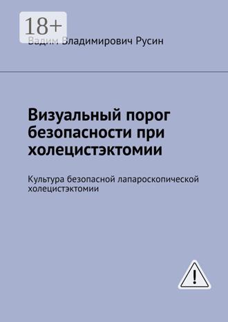 Визуальный порог безопасности при холецистэктоми. Культура безопасной лапароскопической холецистэктомии