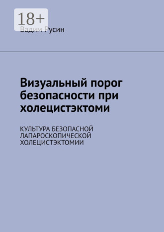 Визуальный порог безопасности при холецистэктоми. Культура безопасной лапароскопической холецистэктомии. 