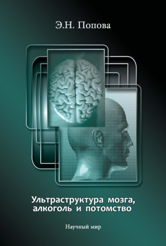 Обложка книги «Ультраструктура мозга, алкоголь и потомство»
