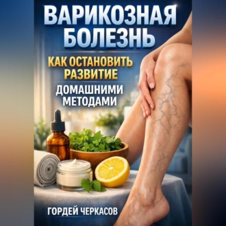 Обложка книги «Варикозная болезнь как остановить развитие домашними методами»