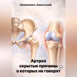 Обложка книги «Артроз: скрытые причины, о которых не говорят»