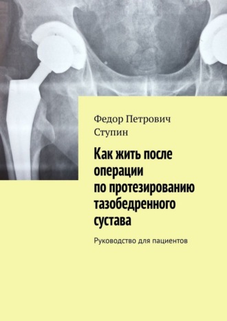 Обложка книги «Как жить после операции по протезированию тазобедренного сустава. Руководство для пациентов»