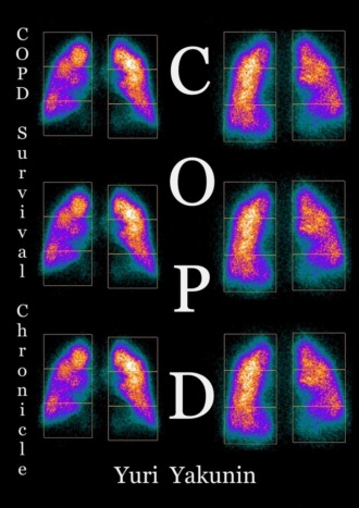 Обложка книги «COPD»