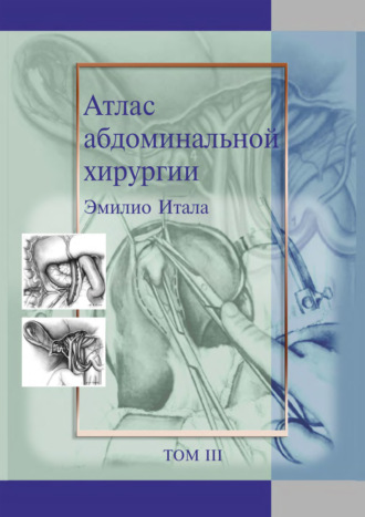 Обложка книги «Атлас абдоминальной хирургии. Том 3. Хирургия тонкой и толстой кишки, прямой кишки и анальной области»