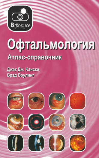 Обложка книги «Офтальмология. Атлас – справочник»