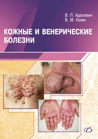Обложка книги «Кожные и венерические болезни»