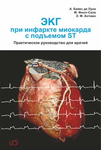 Обложка книги «ЭКГ при инфаркте миокарда с подъемом ST»