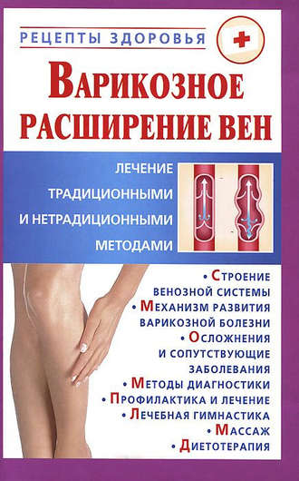 Виктор Горбунов. Варикозное расширение вен. Лечение традиционными и нетрадиционными методами