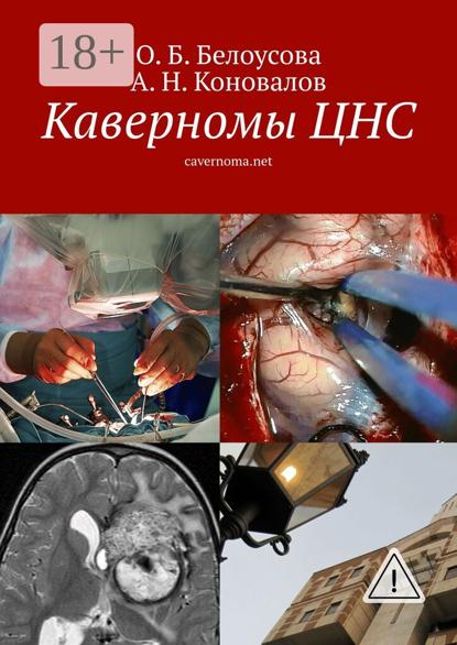 

Каверномы ЦНС. cavernoma.net