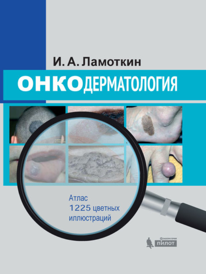 

Онкодерматология. Атлас
