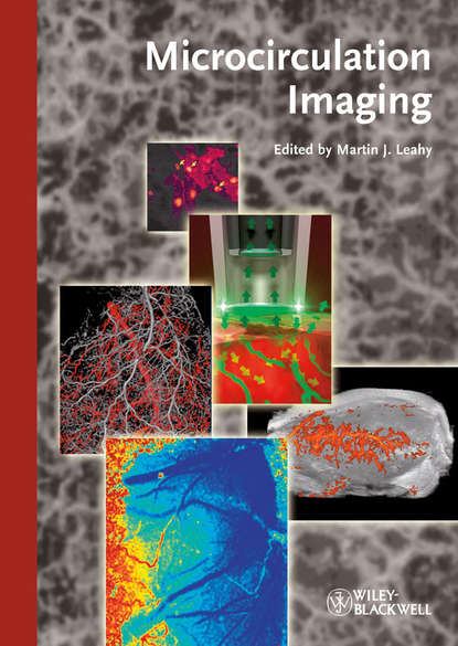 Martin Leahy J. — Microcirculation Imaging