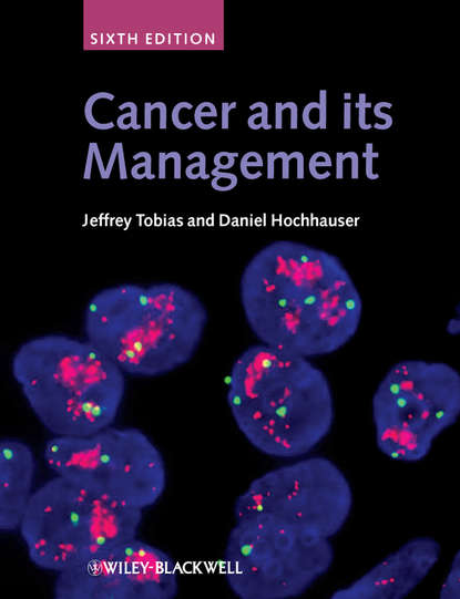 Tobias Jeffrey S. — Cancer and its Management