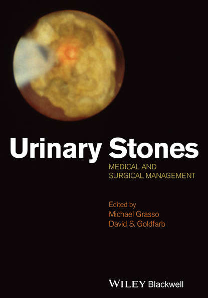 

Urinary Stones. Medical and Surgical Management