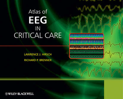 Brenner Richard — Atlas of EEG in Critical Care