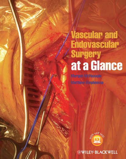 Stephenson Matthew — Vascular and Endovascular Surgery at a Glance