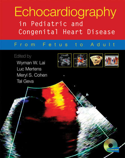 

Echocardiography in Pediatric and Congenital Heart Disease