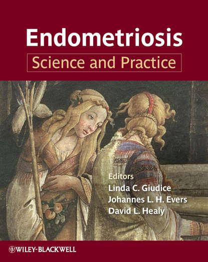 

Endometriosis