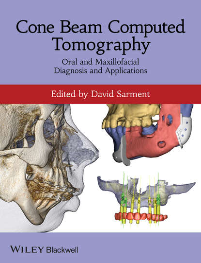 

Cone Beam Computed Tomography