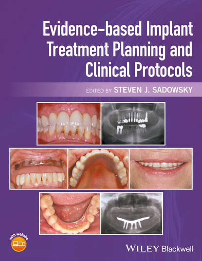 

Evidence-based Implant Treatment Planning and Clinical Protocols