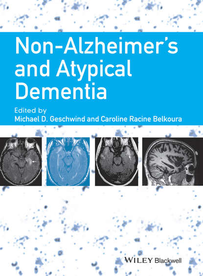 

Non-Alzheimer's and Atypical Dementia