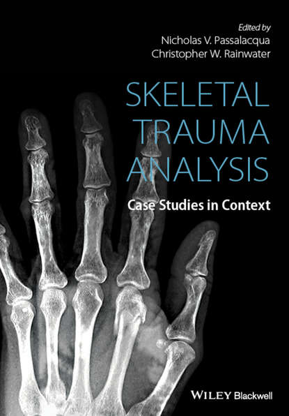 

Skeletal Trauma Analysis