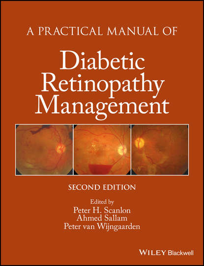 

A Practical Manual of Diabetic Retinopathy Management