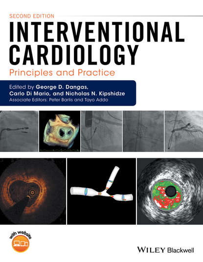 

Interventional Cardiology